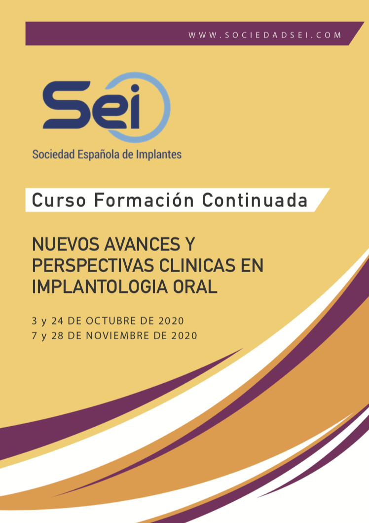 Nuevos avances